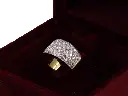 anello fascia MT32623079-644.webp