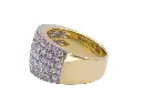 anello fascia MT32623079-646.webp