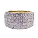 anello fascia MT32623079-645.webp
